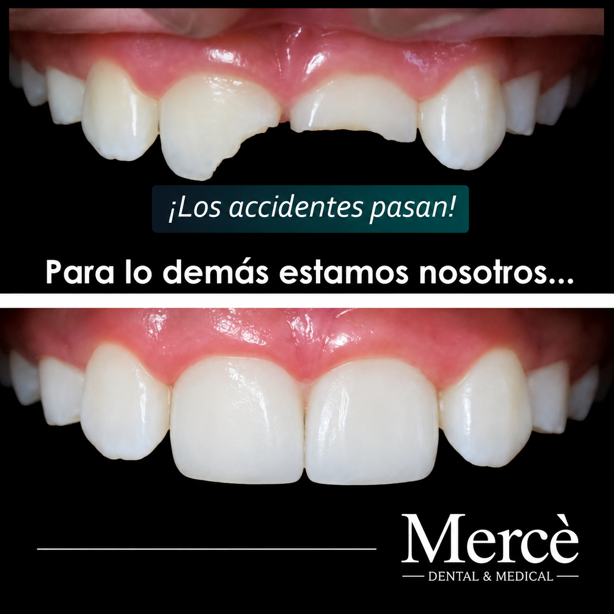 Caso de Éxito 2 - Blanqueamiento dental