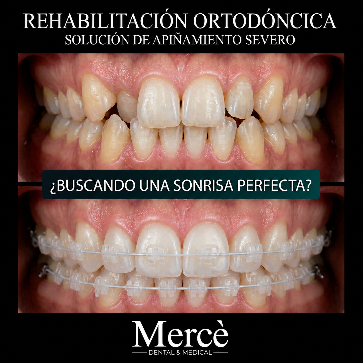 Caso de Éxito 3 - Ortodoncia